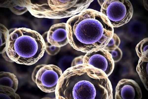 Recombinant Antigens_ Selecting an Expression System